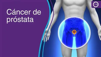 Cáncer de próstata: síntomas, diagnóstico y tratamiento