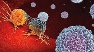 Cancer ¿Qué es, cómo prevenirlo y tratarlo?