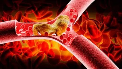 Cómo la suplementación con Immunocal puede prevenir la arterioesclerosis