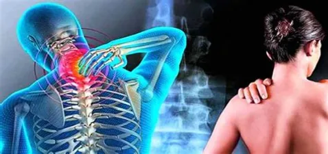 Combatir la fibromialgia: cómo Immunocal puede ayudar a aliviar los síntomas