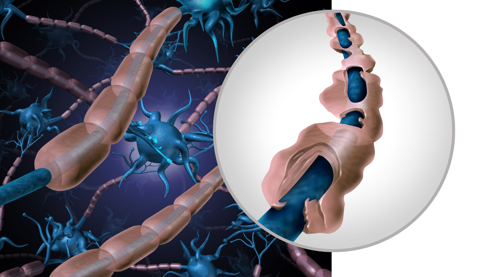 Descubre cómo combatir la Esclerosis Múltiple_ Glutatión, la clave para fortalecer el sistema nervioso (2)